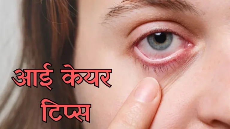 25_05_2024-eye_problem